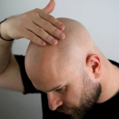 Magic Bald Head & Beard Oil 30ml